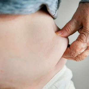 Czy operacja bariatryczna jest bezpieczna