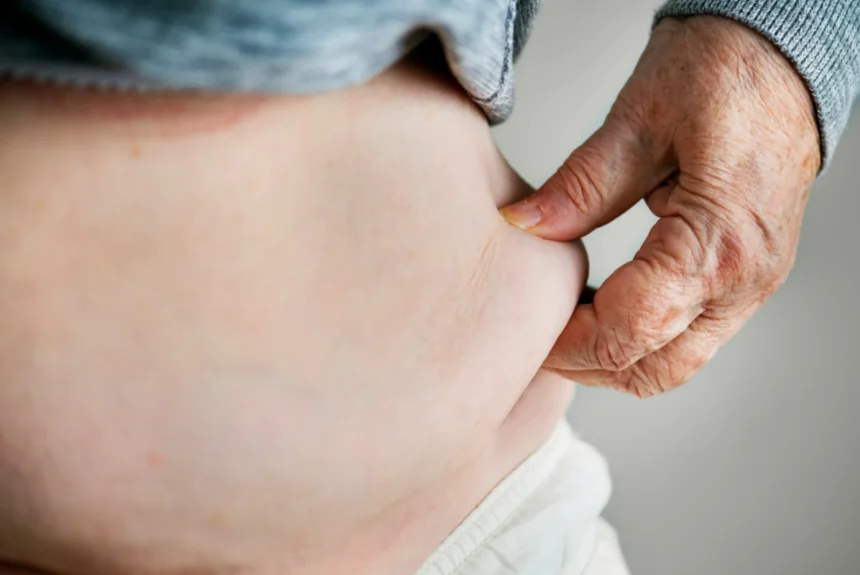 Czy operacja bariatryczna jest bezpieczna